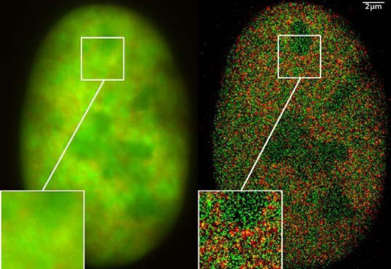 Localisation Microscopy